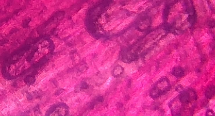 What Stays Where It Is When It Goes Off Riddle  Answer