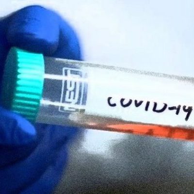 5 Things to Know About a COVID Vaccine: It Won’t Be a ‘Magic Wand’
